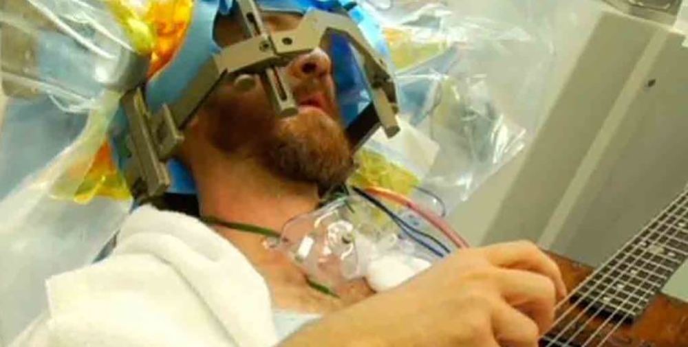 Impresionante: un hombre tocó la guitarra mientras le operaban el cerebro