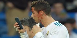 Cristiano Ronaldo pidió un celular para ver una herida en su ceja y los memes no tardaron en aparecer