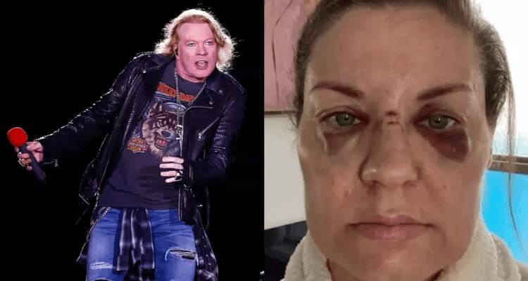 Tras herir a una fan, Axl Rose decidió no lanzar más su micrófono al público